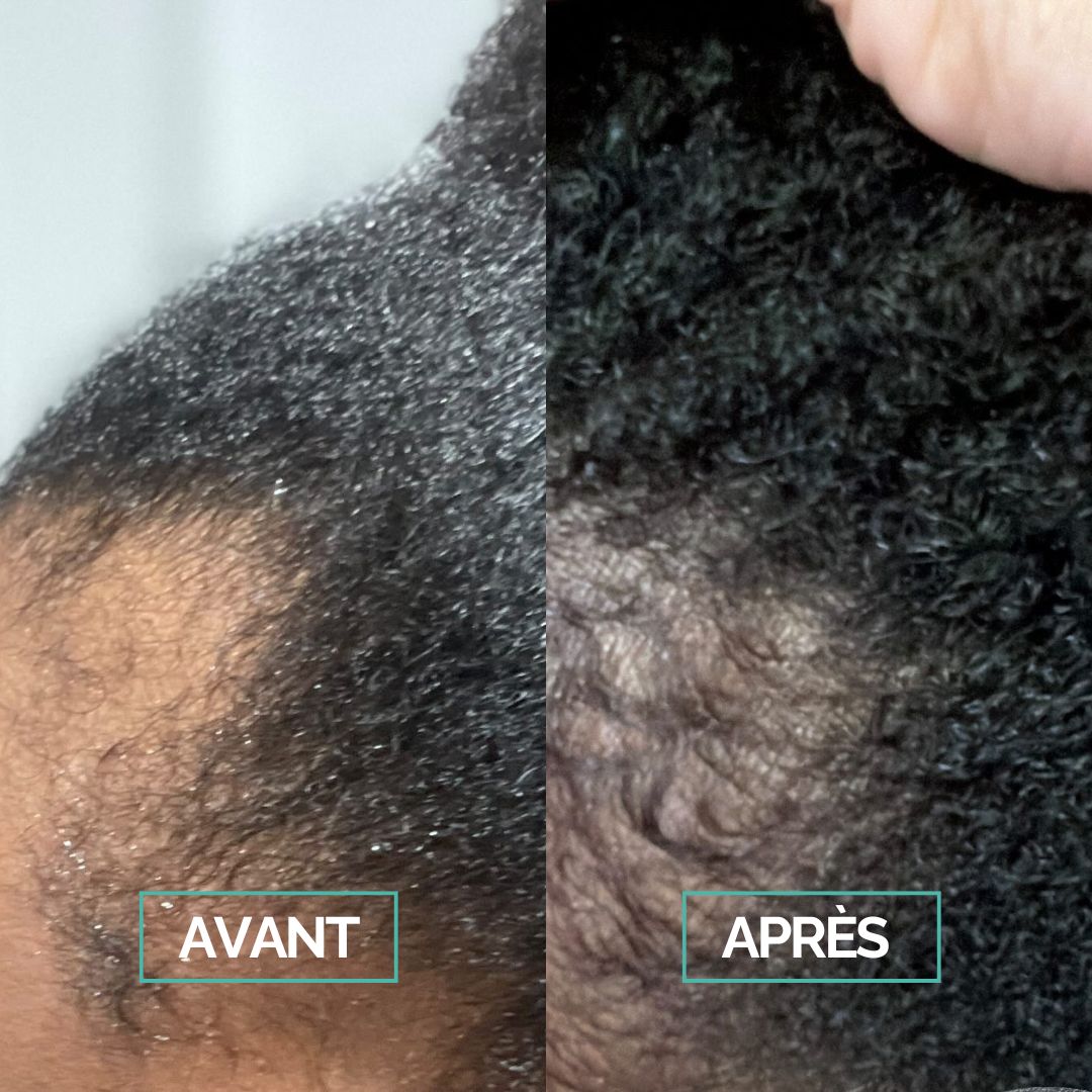 Serum Boost & Scalp - 50ml - In Haircare
