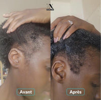 Vorher Nachher Haarwachstumskur In Haircare